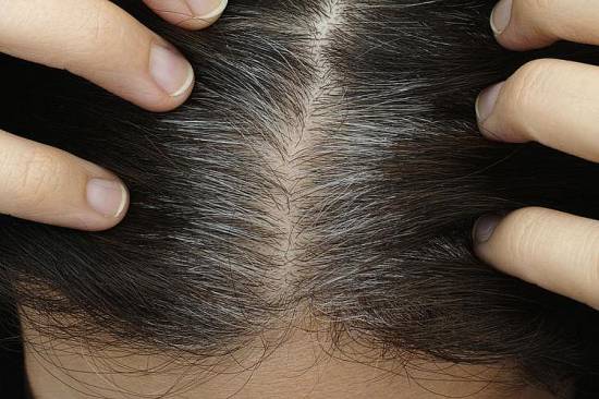 Πρόωρο γκριζάρισμα μαλλιών: 7 πιθανές αιτίες